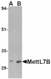 Western blot - MettL7B Antibody from Signalway Antibody (24786) - Antibodies.com