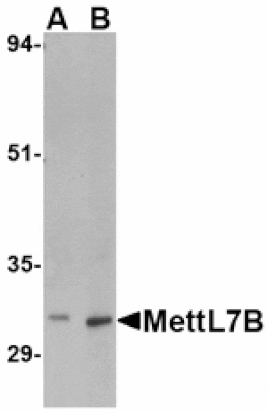 Western blot - MettL7B Antibody from Signalway Antibody (24786) - Antibodies.com