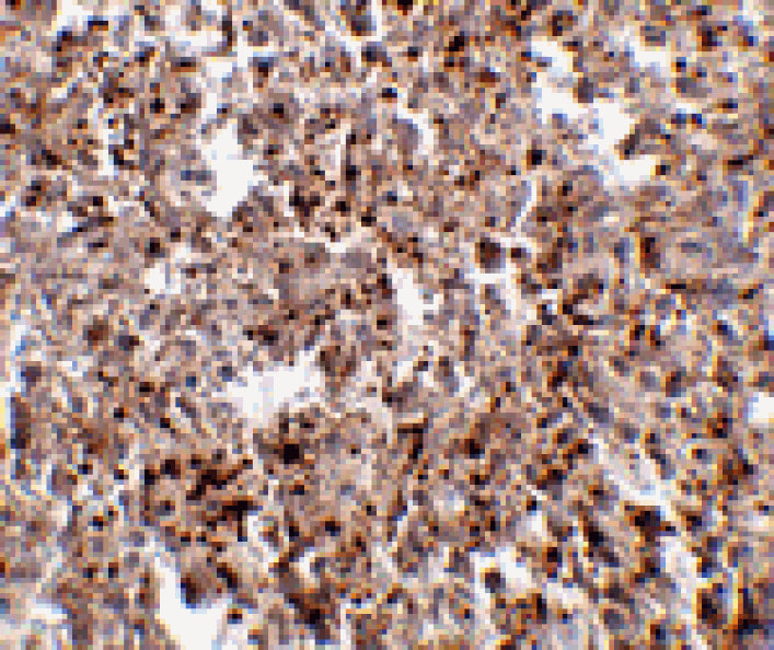 Immunohistochemistry - MettL7B Antibody from Signalway Antibody (24786) - Antibodies.com
