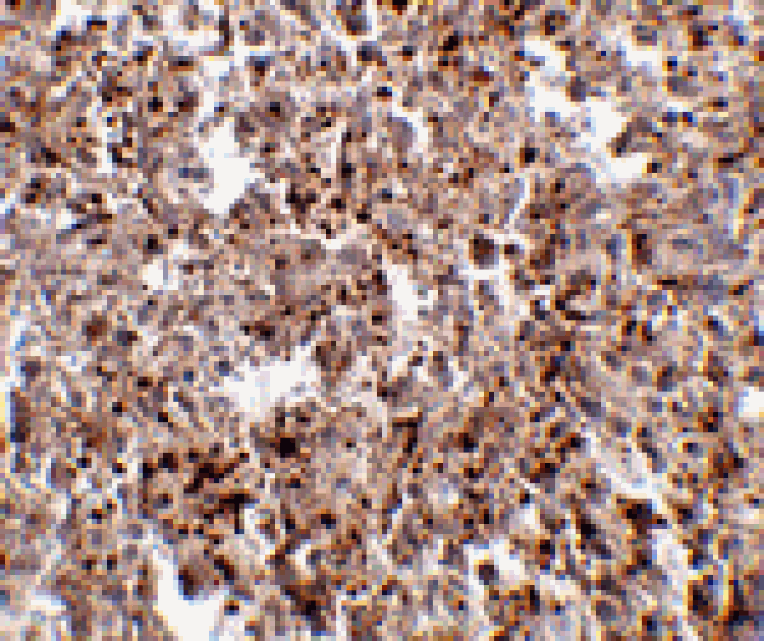Immunohistochemistry - MettL7B Antibody from Signalway Antibody (24786) - Antibodies.com