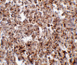 Immunohistochemistry - MettL7B Antibody from Signalway Antibody (24786) - Antibodies.com