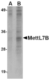 Western blot - MettL7B Antibody from Signalway Antibody (24791) - Antibodies.com