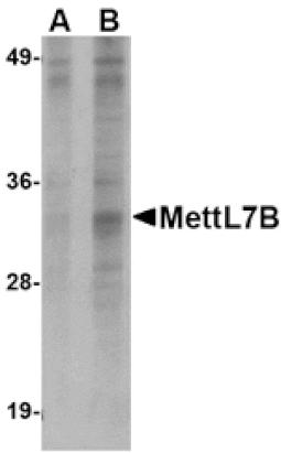 Western blot - MettL7B Antibody from Signalway Antibody (24791) - Antibodies.com