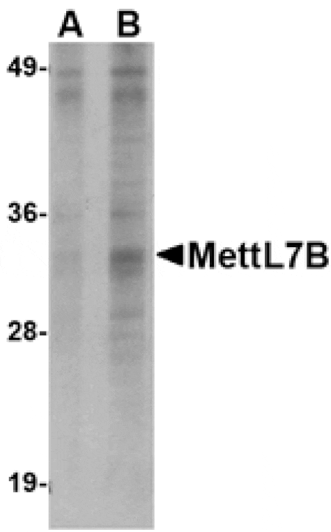 Western blot - MettL7B Antibody from Signalway Antibody (24791) - Antibodies.com