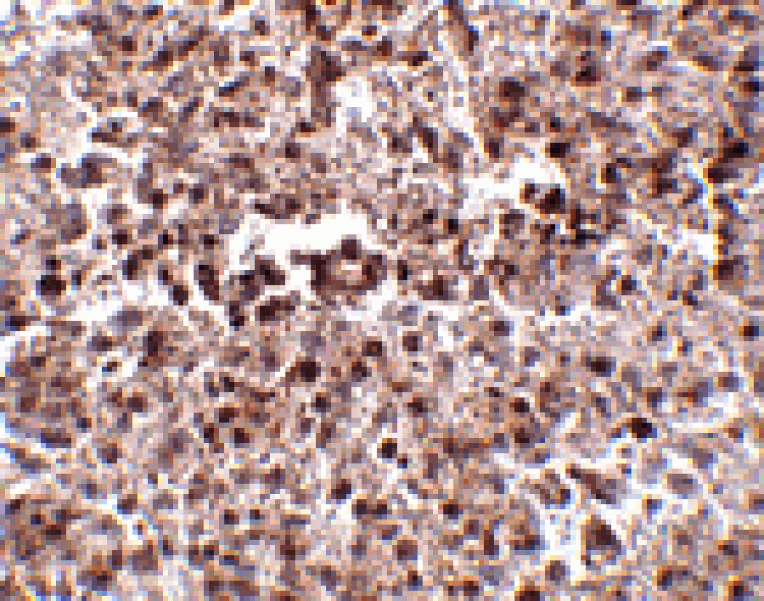 Immunohistochemistry - MettL7B Antibody from Signalway Antibody (24791) - Antibodies.com