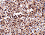 Immunohistochemistry - MettL7B Antibody from Signalway Antibody (24791) - Antibodies.com
