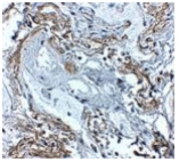 Immunohistochemistry - TNFAIP3 Antibody from Signalway Antibody (24878) - Antibodies.com