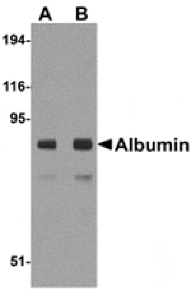 Western blot - Albumin Antibody from Signalway Antibody (24891) - Antibodies.com