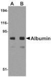 Western blot - Albumin Antibody from Signalway Antibody (24891) - Antibodies.com