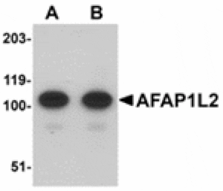 Western blot - AFAP1L2 Antibody from Signalway Antibody (24913) - Antibodies.com