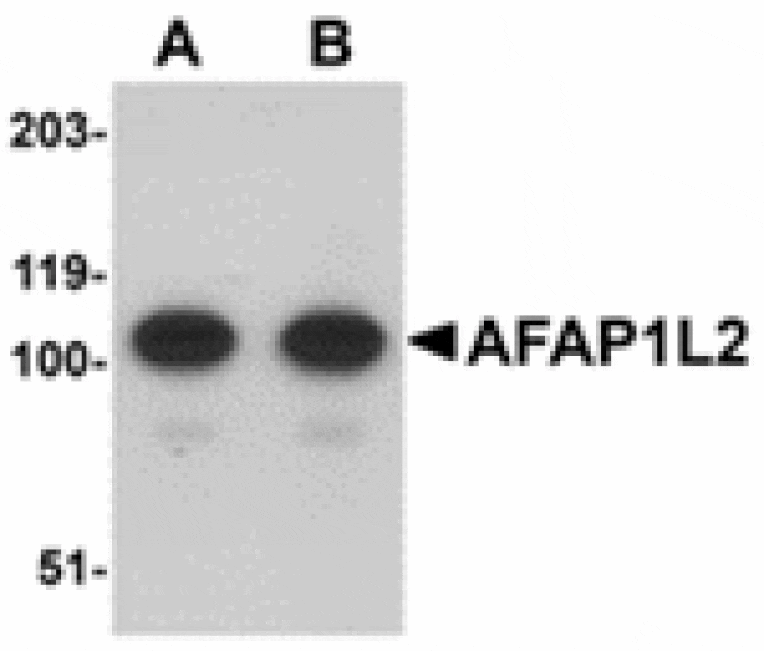 Western blot - AFAP1L2 Antibody from Signalway Antibody (24913) - Antibodies.com