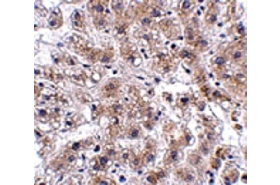 Immunohistochemistry - AFAP1L2 Antibody from Signalway Antibody (24913) - Antibodies.com
