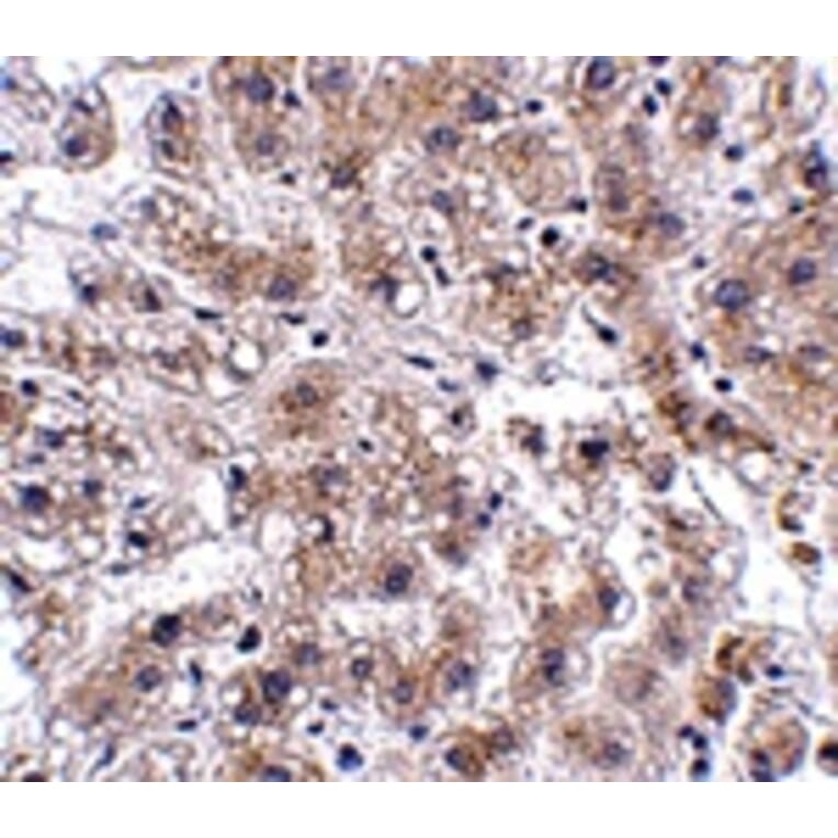 Immunohistochemistry - AFAP1L2 Antibody from Signalway Antibody (24913) - Antibodies.com