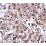 Immunohistochemistry - AFAP1L2 Antibody from Signalway Antibody (24913) - Antibodies.com