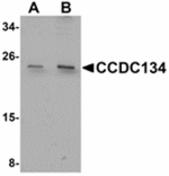 Western blot - CCDC134 Antibody from Signalway Antibody (24933) - Antibodies.com