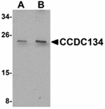 Western blot - CCDC134 Antibody from Signalway Antibody (24933) - Antibodies.com