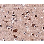 Immunohistochemistry - CCDC134 Antibody from Signalway Antibody (24933) - Antibodies.com