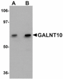Western blot - GALNT10 Antibody from Signalway Antibody (24939) - Antibodies.com