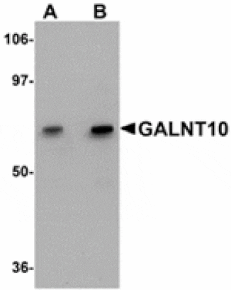 Western blot - GALNT10 Antibody from Signalway Antibody (24939) - Antibodies.com