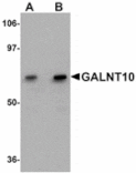 Western blot - GALNT10 Antibody from Signalway Antibody (24939) - Antibodies.com