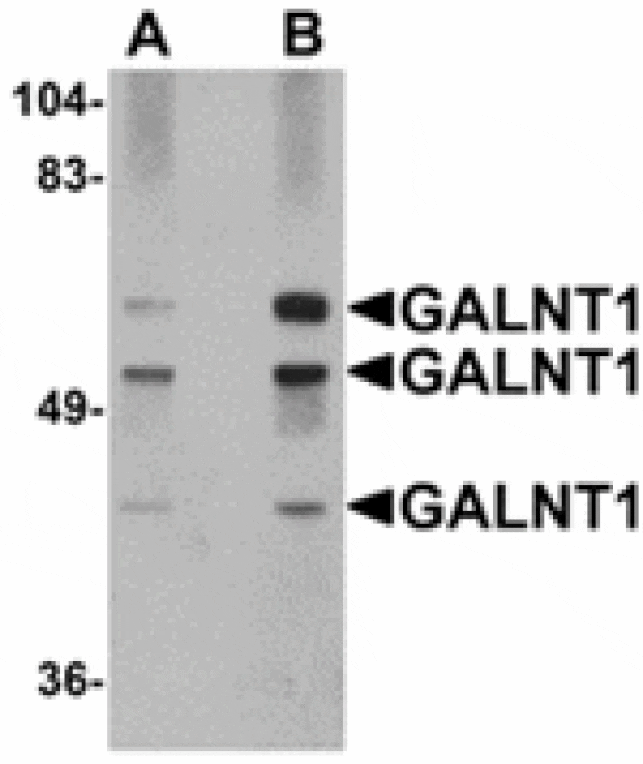 Western blot - GALNT10 Antibody from Signalway Antibody (24940) - Antibodies.com