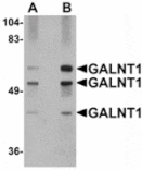Western blot - GALNT10 Antibody from Signalway Antibody (24940) - Antibodies.com