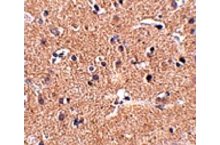 Immunohistochemistry - GALNT10 Antibody from Signalway Antibody (24940) - Antibodies.com