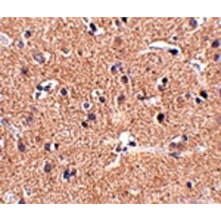 Immunohistochemistry - GALNT10 Antibody from Signalway Antibody (24940) - Antibodies.com
