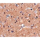 Immunohistochemistry - GALNT10 Antibody from Signalway Antibody (24940) - Antibodies.com