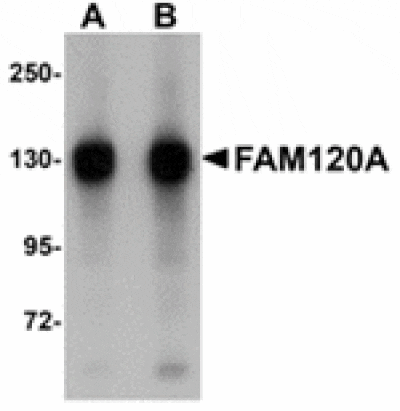 Western blot - FAM120A Antibody from Signalway Antibody (24950) - Antibodies.com
