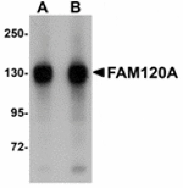 Western blot - FAM120A Antibody from Signalway Antibody (24950) - Antibodies.com