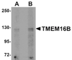 Western blot - TMEM16B Antibody from Signalway Antibody (24980) - Antibodies.com