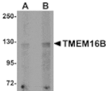 Western blot - TMEM16B Antibody from Signalway Antibody (24980) - Antibodies.com