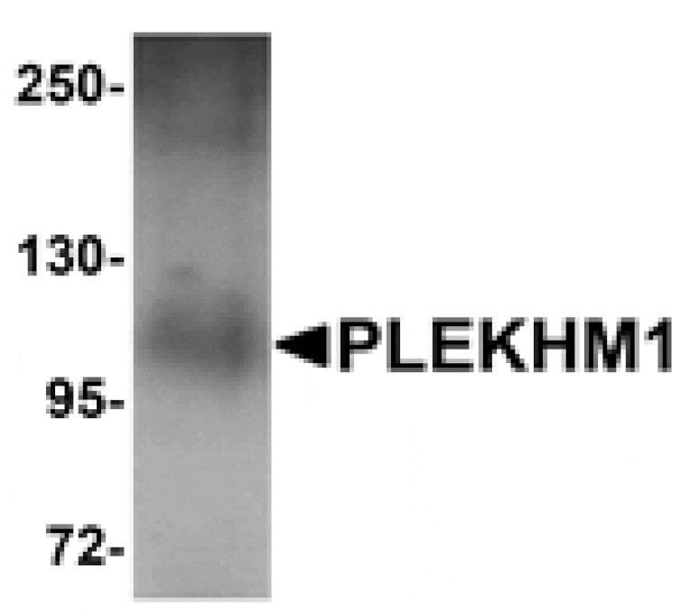 Western blot - PLEKHM1 Antibody from Signalway Antibody (25003) - Antibodies.com