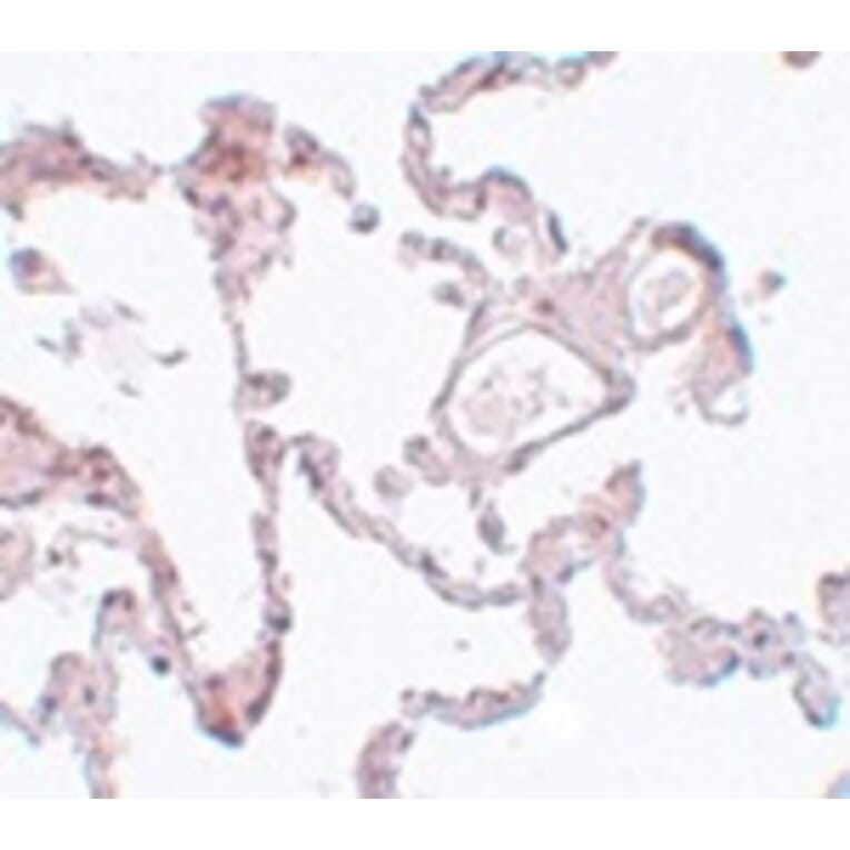 Immunohistochemistry - PLEKHM1 Antibody from Signalway Antibody (25003) - Antibodies.com