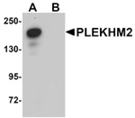 Western blot - PLEKHM2 Antibody from Signalway Antibody (25004) - Antibodies.com