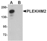 Western blot - PLEKHM2 Antibody from Signalway Antibody (25004) - Antibodies.com