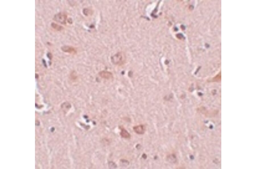 Immunohistochemistry - PLEKHM2 Antibody from Signalway Antibody (25004) - Antibodies.com