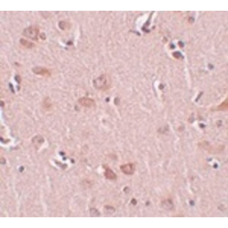 Immunohistochemistry - PLEKHM2 Antibody from Signalway Antibody (25004) - Antibodies.com