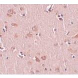 Immunohistochemistry - PLEKHM2 Antibody from Signalway Antibody (25004) - Antibodies.com