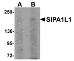 Western blot analysis of SIPA1L1 in rat brain tissue lysate with SIPA1L1 antibody at (A) 0.5 and (B) 1 µg/mL.