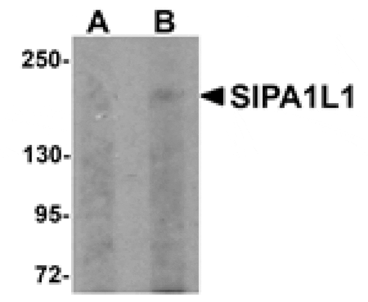 Western blot - SIPA1L1 Antibody from Signalway Antibody (25006) - Antibodies.com