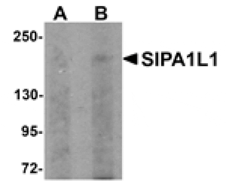 Western blot - SIPA1L1 Antibody from Signalway Antibody (25006) - Antibodies.com