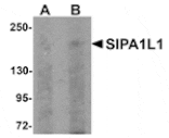 Western blot - SIPA1L1 Antibody from Signalway Antibody (25006) - Antibodies.com