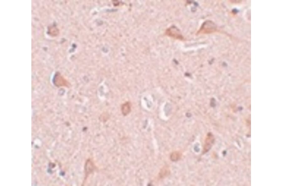 Immunohistochemistry - SIPA1L1 Antibody from Signalway Antibody (25006) - Antibodies.com