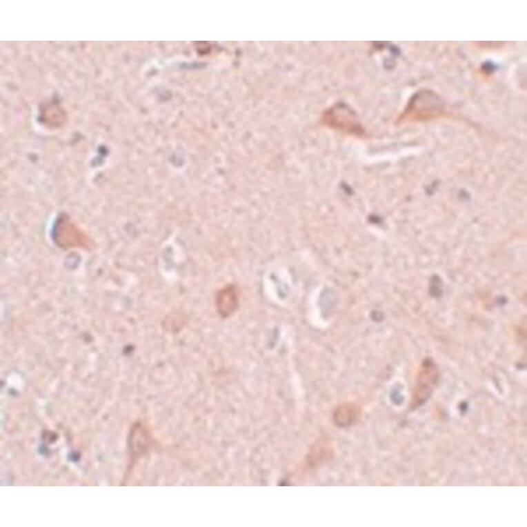 Immunohistochemistry - SIPA1L1 Antibody from Signalway Antibody (25006) - Antibodies.com