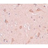 Immunohistochemistry - SIPA1L1 Antibody from Signalway Antibody (25006) - Antibodies.com