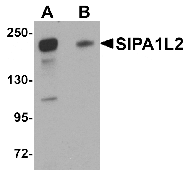 Western blot - SIPA1L2 Antibody from Signalway Antibody (25007) - Antibodies.com