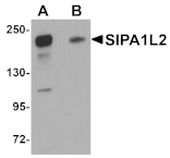 Western blot - SIPA1L2 Antibody from Signalway Antibody (25007) - Antibodies.com