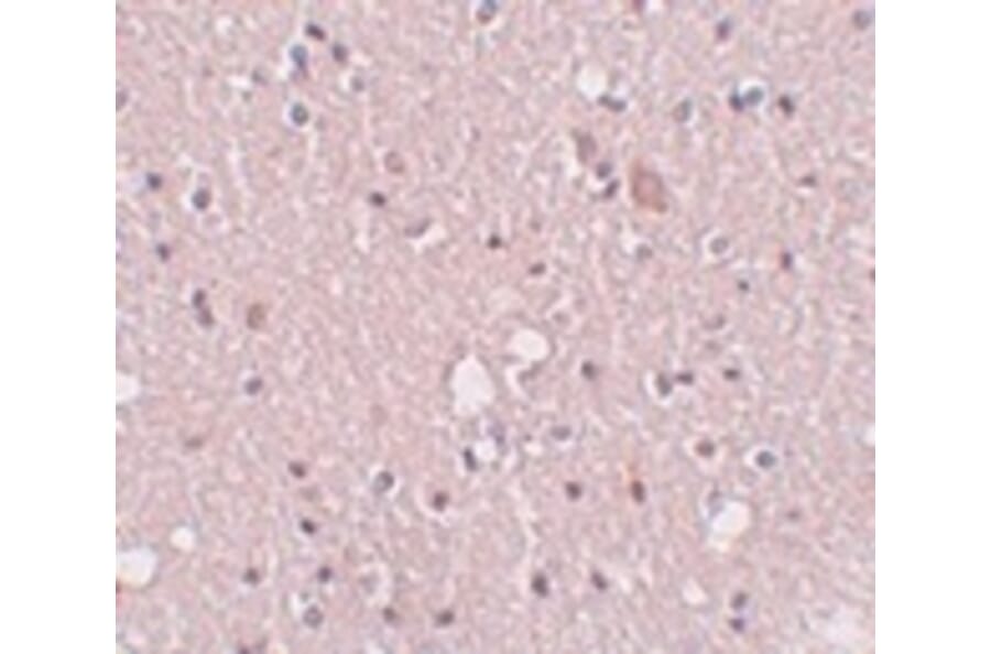 Immunohistochemistry - SIPA1L2 Antibody from Signalway Antibody (25007) - Antibodies.com